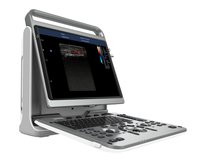 Портативный узи-аппарат Sonotouch 60