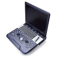 УЗИ-аппарат SIUI Apogee 1100 Diamond