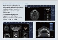 Finscan новый томограф клкт дентальный 2026