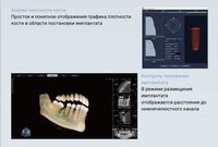 Finscan новый томограф клкт дентальный 2026