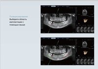 Finscan новый томограф клкт дентальный 2026