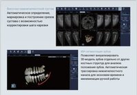 Finscan новый томограф клкт дентальный 2026